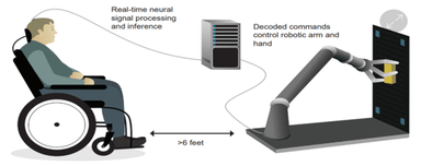 Brain-Computer Interfaces (BCI)